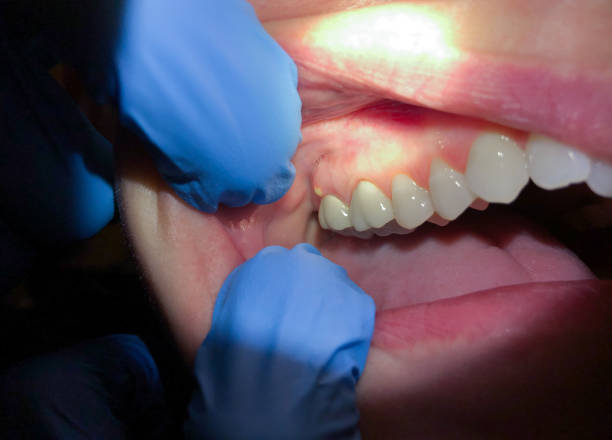 Best Emergency Treatment for Jaw Pain or Injury in Alliae, NC