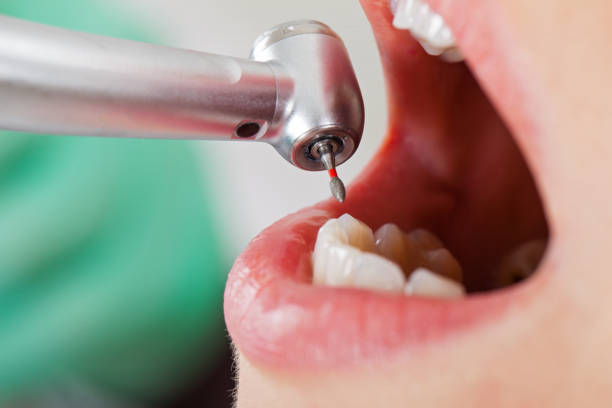 Best Weekend Emergency Dental Services in Alliae, NC